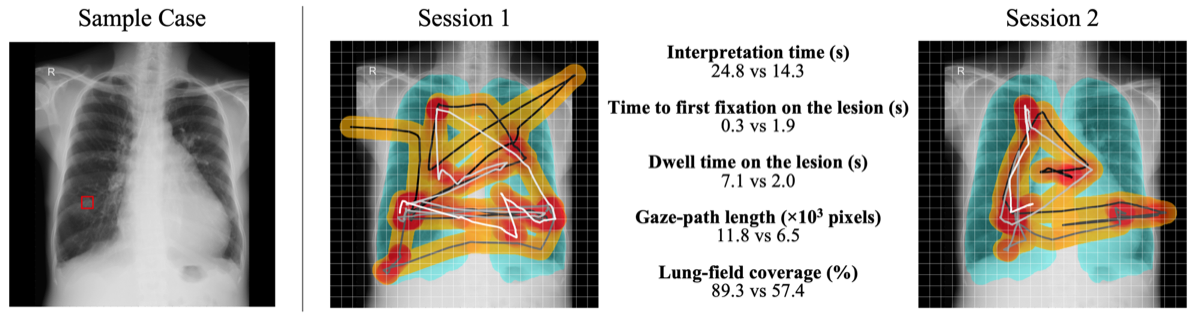 Eye-tracking